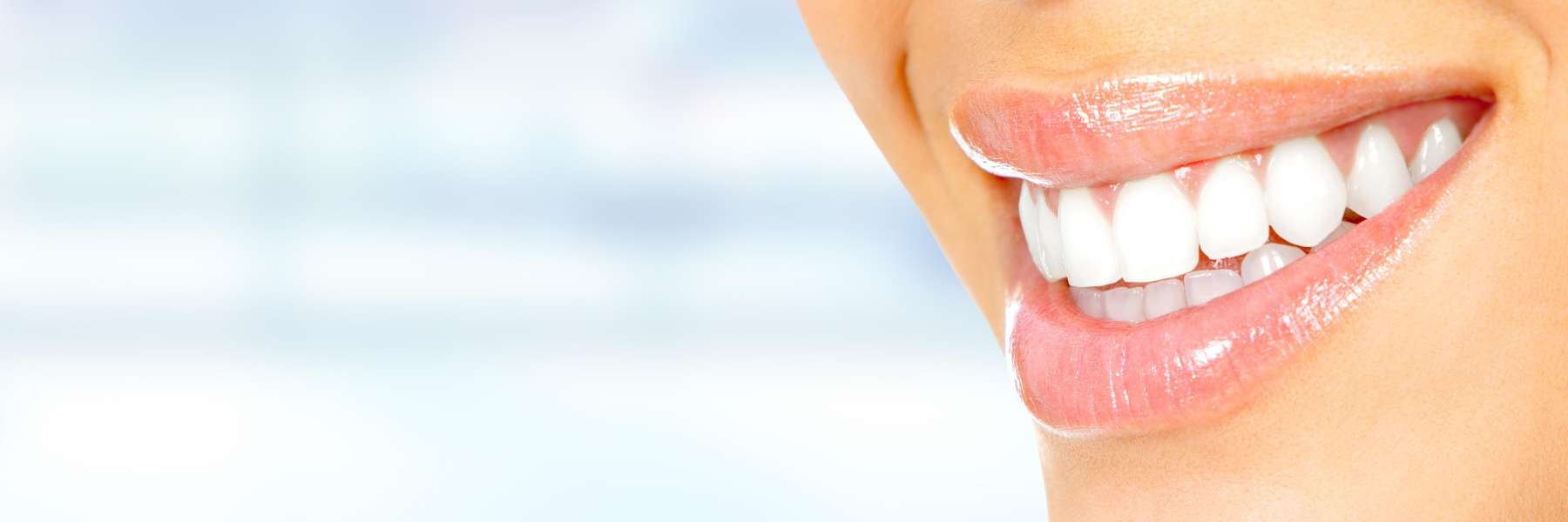 Lady's teeth after getting veneers at the Philadelphia Dentist