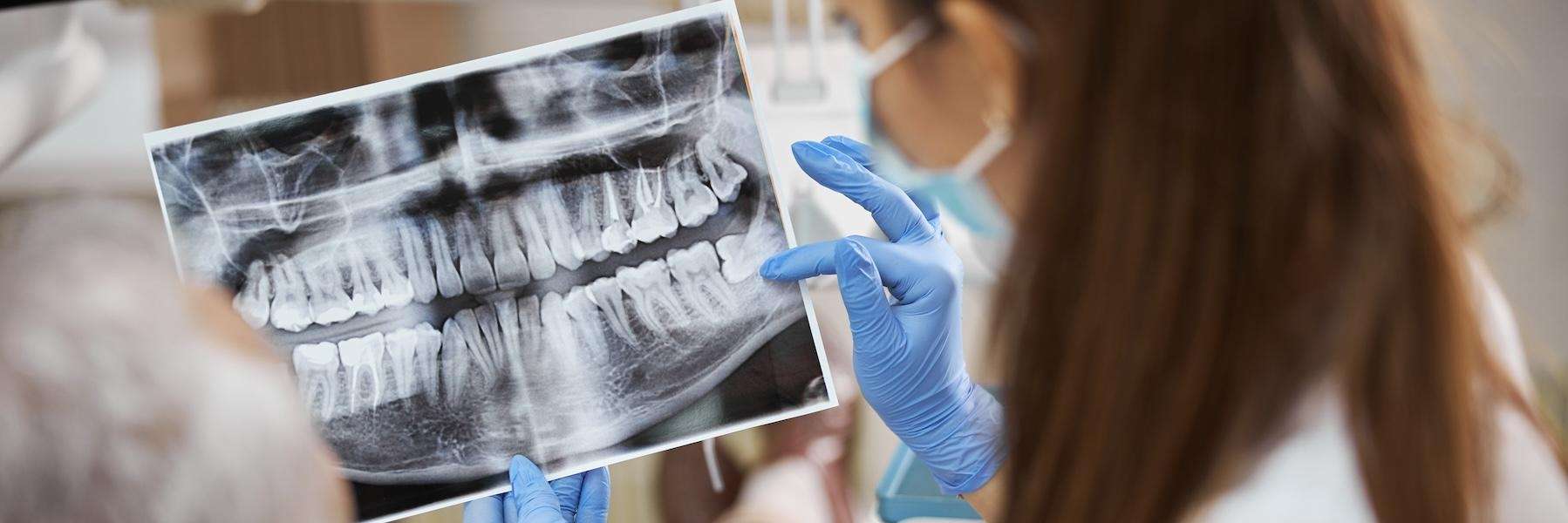 An x-ray picture of patient's teeth in Philadelphia